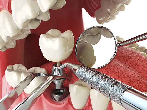Best Cracked Tooth Emergency Dentist  in Accokeek, MD